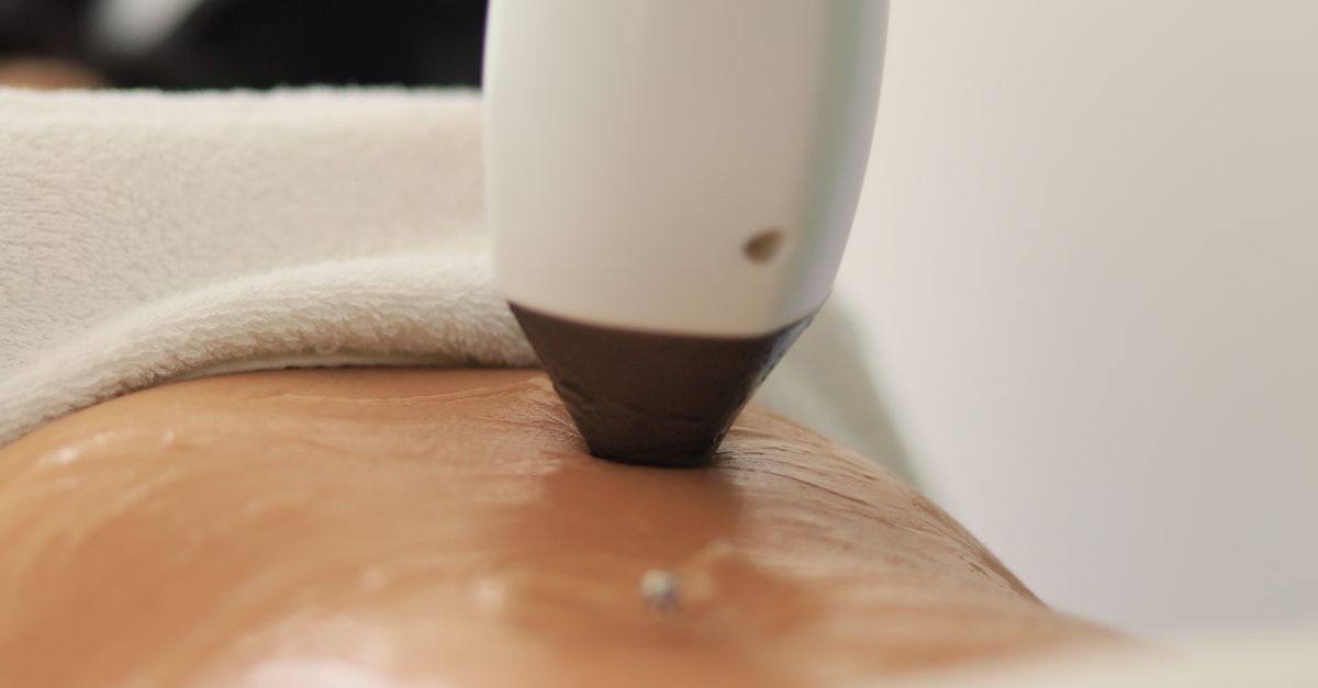 Comparing Surgical vs Non-Surgical Skin Tightening Solutions