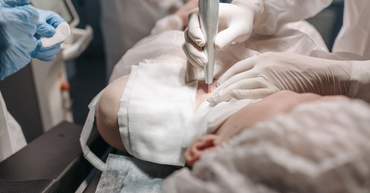 The Science Behind Chemical Peels: How They Work on Your Skin